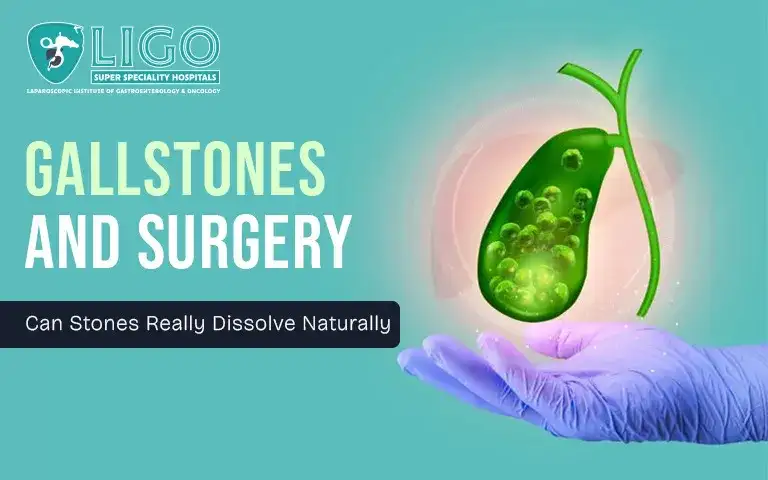 Can Gallstones Dissolve Naturally or Is Surgery Inevitable?